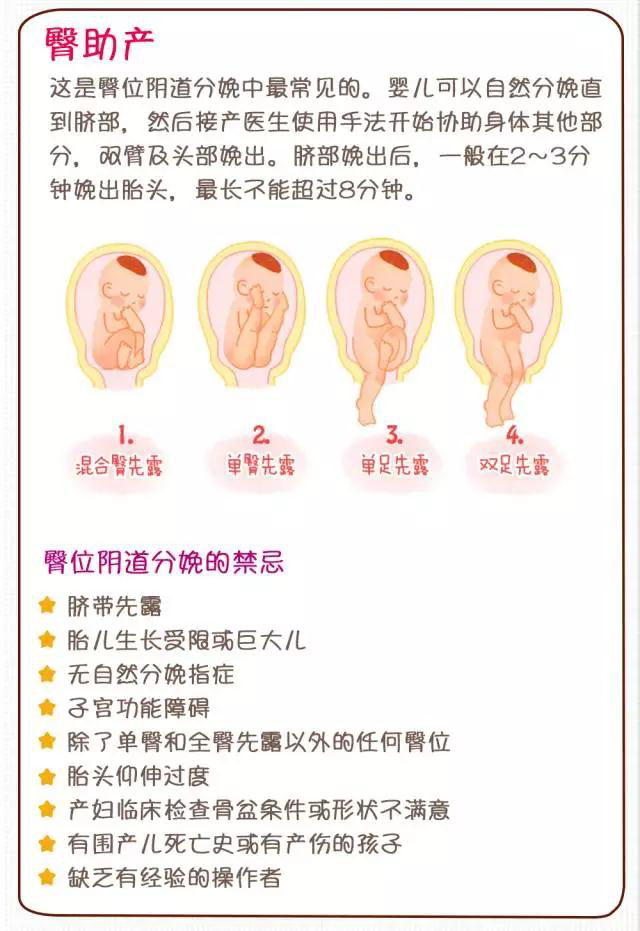 臀位剖宫产的步骤图片图片